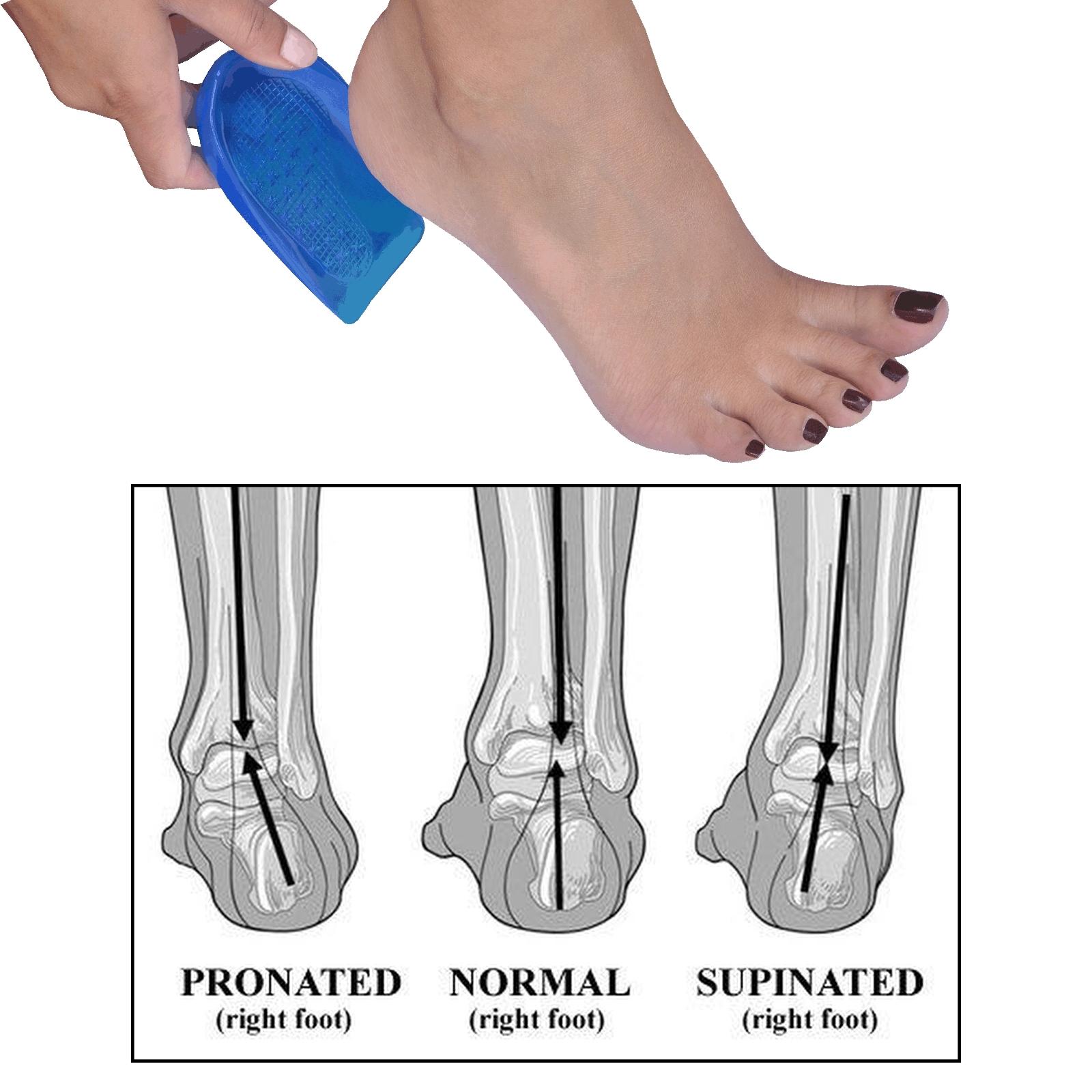 Gel Posture Heel Leveling Foot Supports Angled Correcting Pronation Supination Ebay 