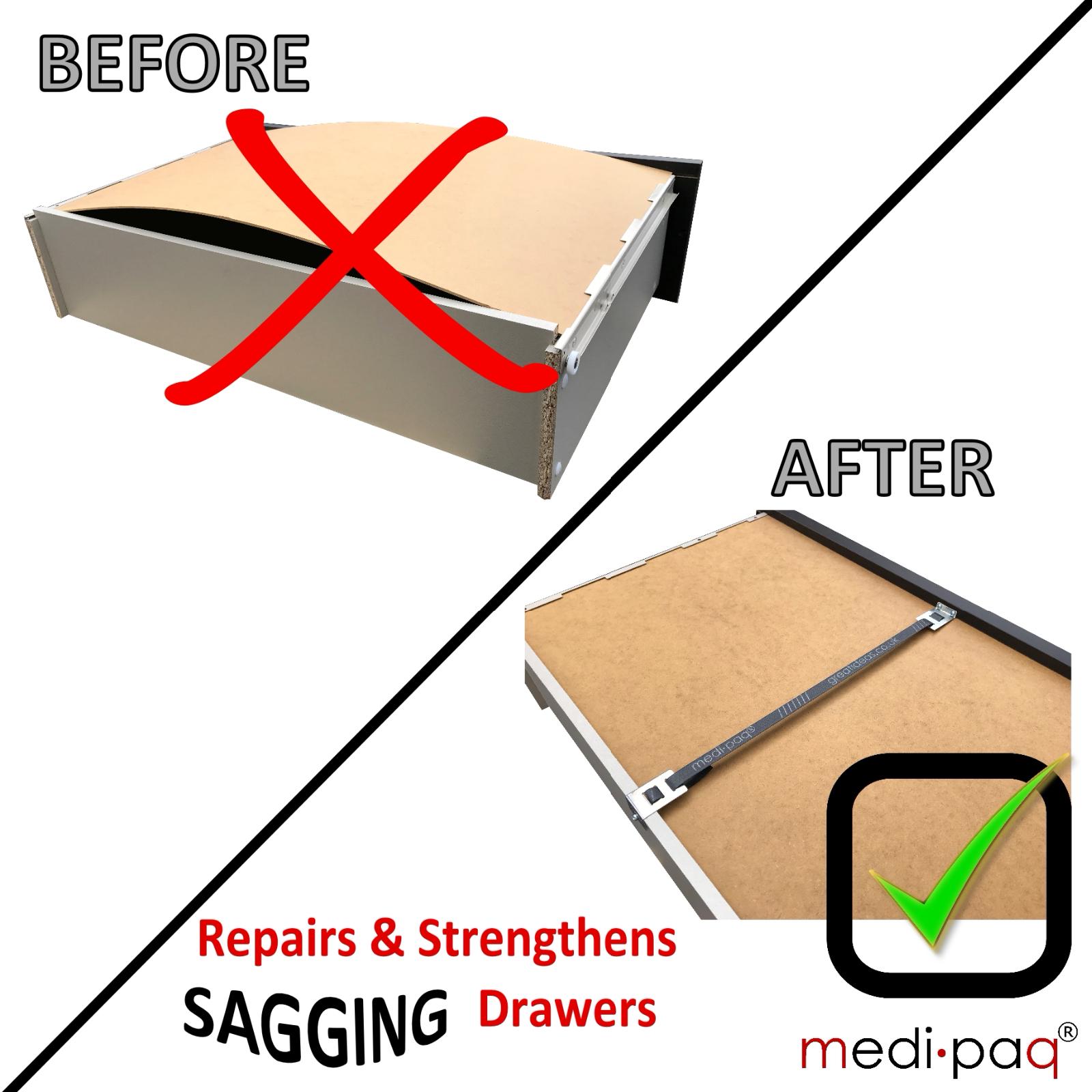 6 Extra Strong Drawer Repair Kits Fix Mend Sagging Broken Buckled